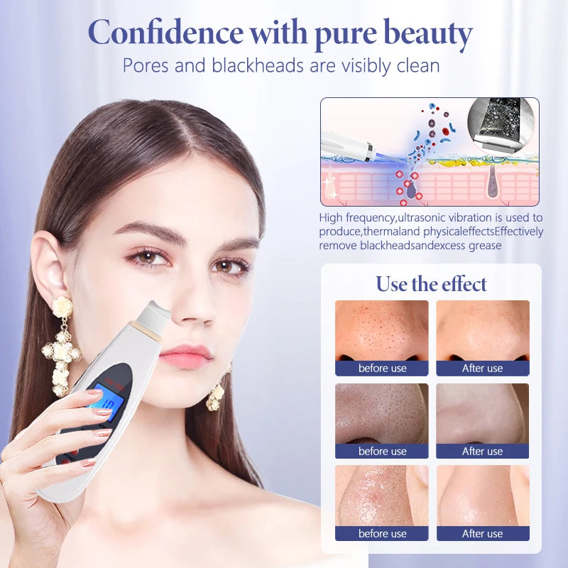 NEW Arrivals Ultrasonic Skin Scrubber Deep Face Cleaning Machine Wrinkles Remove Eye Bags Facial Massager Ultrasound Peeling Clean Tone Lifting Device Ladies Beauty Salon SPA Accessories Skin Care Products