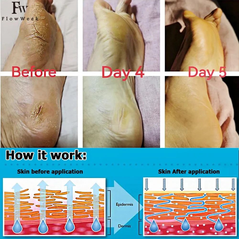 FlowWeek Herbal Anti Crack Foot Cream Anti-Drying Anti-Freeze Crack Feet Mask Heel Cracked Repair Removal Hand Feet Dead Skin