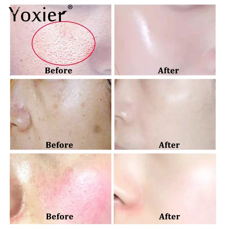 Yoxier 3Pcs/Lot Peony Nourishing Snail Cream Anti-Aging Face Cream Wrinkle Whitening Moisturizing Oil Control Skin Care