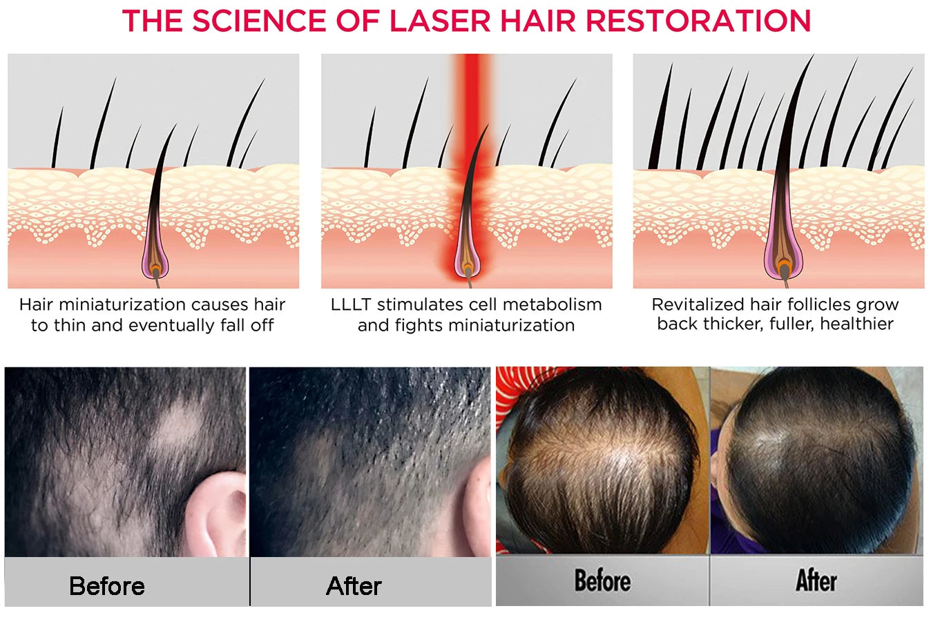 NEW Arrivals Laser Infrared Light Regrowth Hat Red Light Device for Hair Anti-Loss Hair Growth Laser Cap Hat LED Light Helmet Women Men Hair Care Accessories