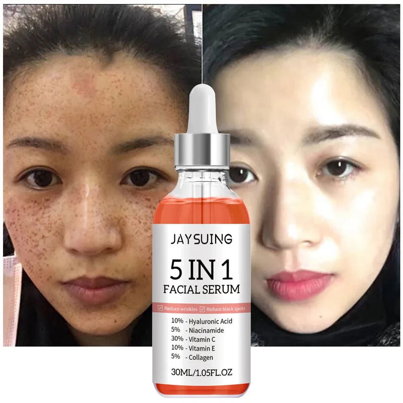Hyaluronic Acid Wrinkle Remover Serum Niacinamide Fade Dark Spot Shrink Pores 5 In 1 Whitening For Moisturizing Face Skin Care
