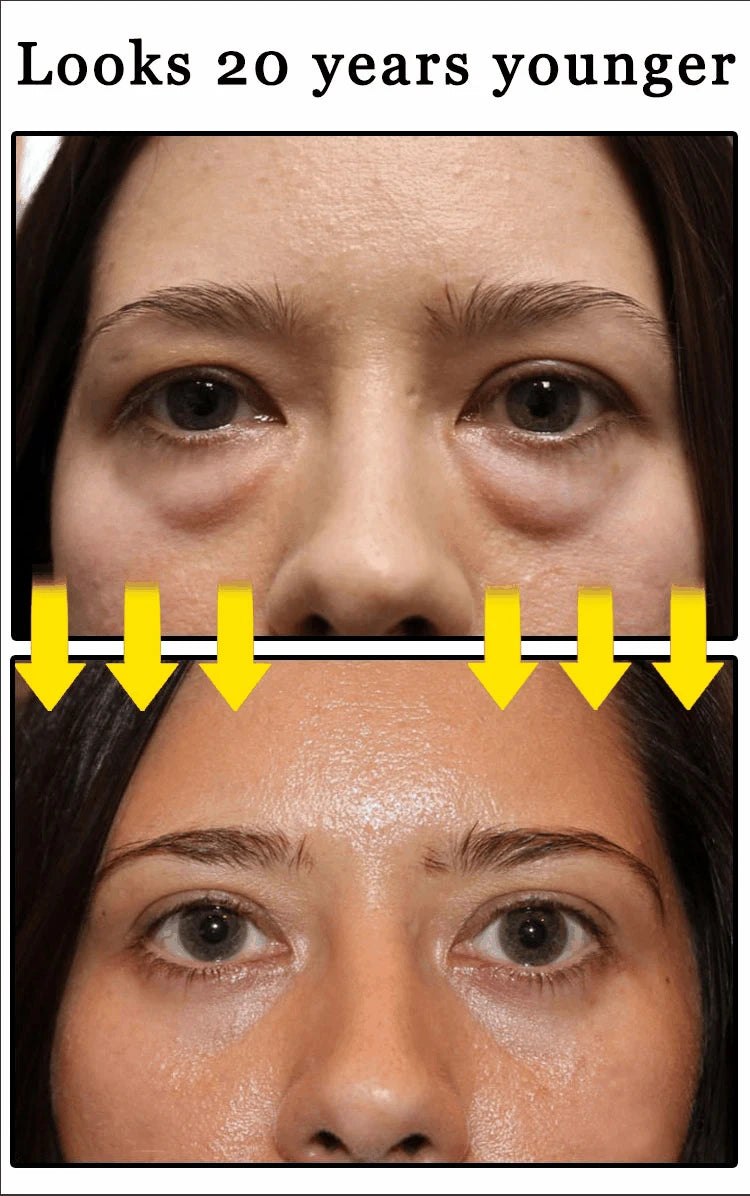 NEW Buy 10 Get 12 Free Korean Snail Eye Cream Collagen Fade Fine Lines Wrinkle Lightening Dark Circles Firming Eye Bags Puffiness Moisturizing Eye Cream Women Beauty Supplies