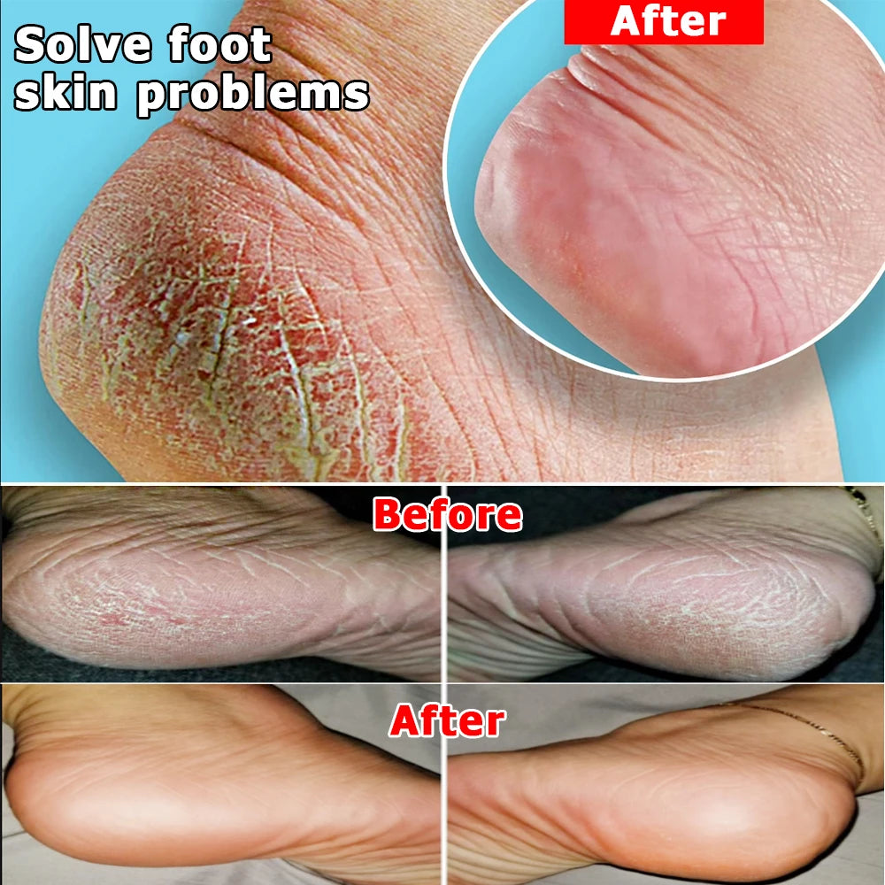 FlowWeek Herbal Anti Crack Foot Cream Anti-Drying Anti-Freeze Crack Feet Mask Heel Cracked Repair Removal Hand Feet Dead Skin