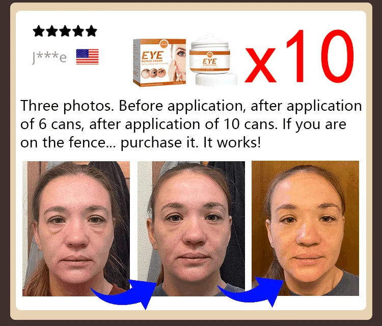 NEW Buy 10 Get 12 Free Korean Snail Eye Cream Collagen Fade Fine Lines Wrinkle Lightening Dark Circles Firming Eye Bags Puffiness Moisturizing Eye Cream Women Beauty Supplies