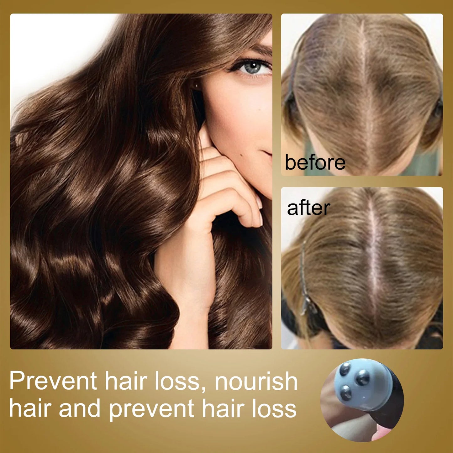 Hair Growth Essence Oil Roll-on Massage The Scalp To Accelerate Absorption Scalp Irritation Nourish Hair Roots Prevent Hair Loss
