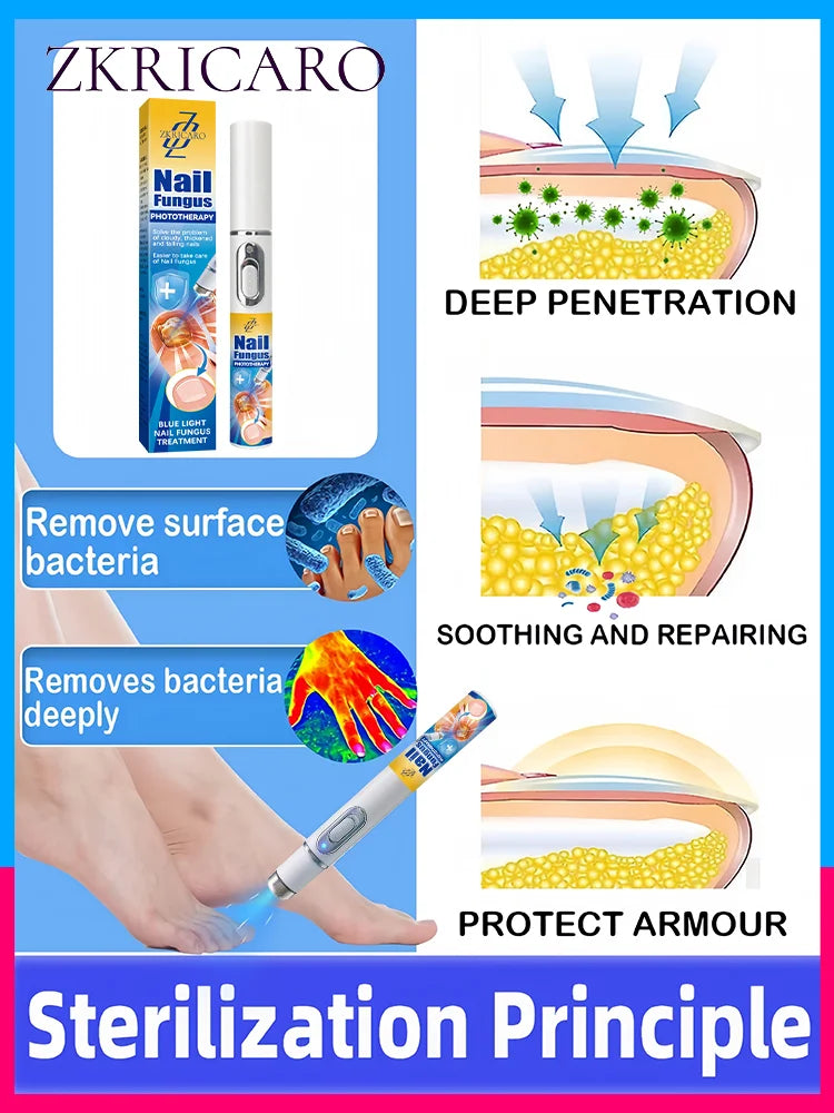 Hot Sellers: Buy 3 Get 2 Free : Nail Cleaning Tools, Blue Light Laser Tools Root Repair Onychomycosis Fungus Toenail Hands Finger Treatment Upgraded to Second Generation Women Men Skin Care Supplies