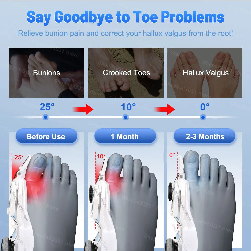 NEW Arrivals Bunion Corrector Unisex Foot Hallux Valgus Braces Rotatable Separator Straightener Adjustable Pedicure Finger Corrector Sports Medical Devices Set Supplies Health Care Products