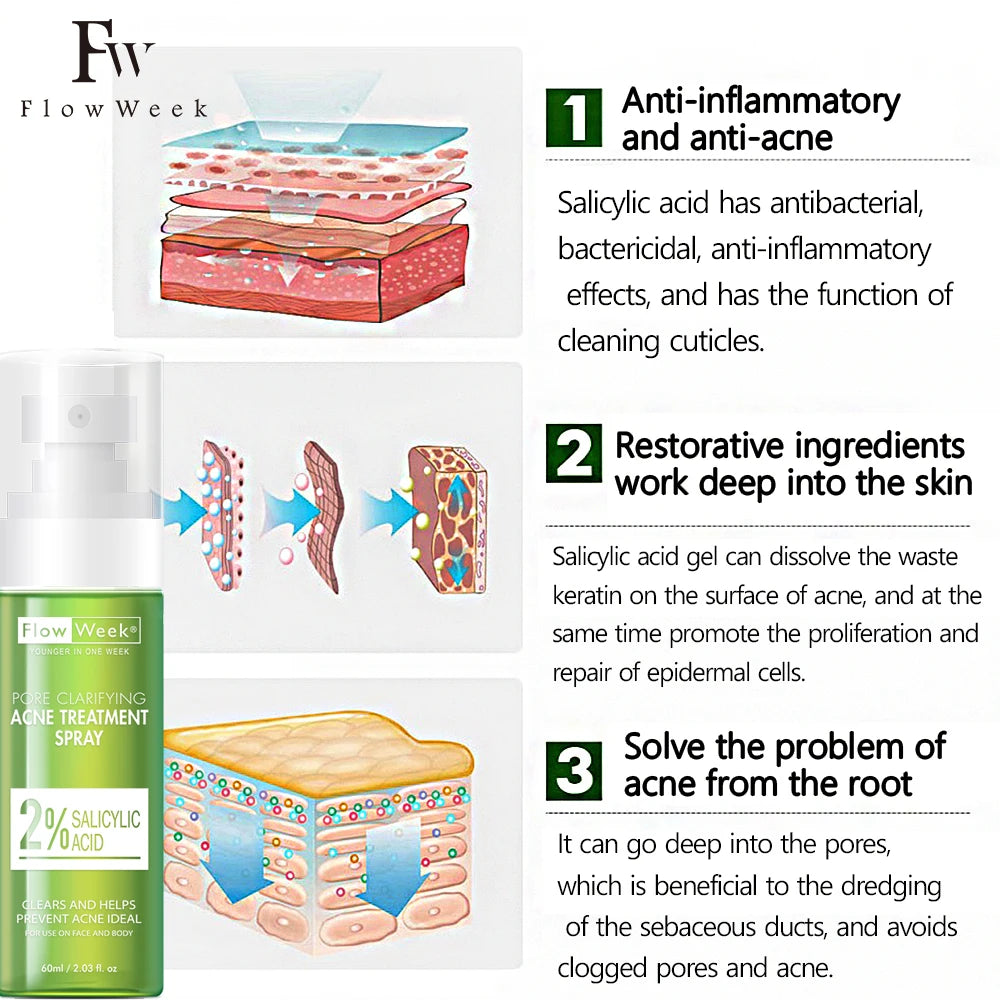 FlowWeek Salicylic Acid Acne Removal Spray,Remove Acne Cream, Back Spray, Face Body Acne Spray, Pimple Remover, Acne Treatment