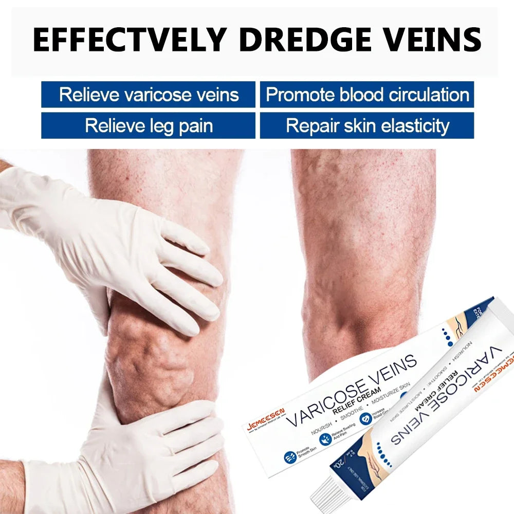 Jemeesen Potent Varicose Veins Relief Cream Leg Vasculitis Phlebitis Spider Shape Vein Pain Relief Ointment Angiitis Removal