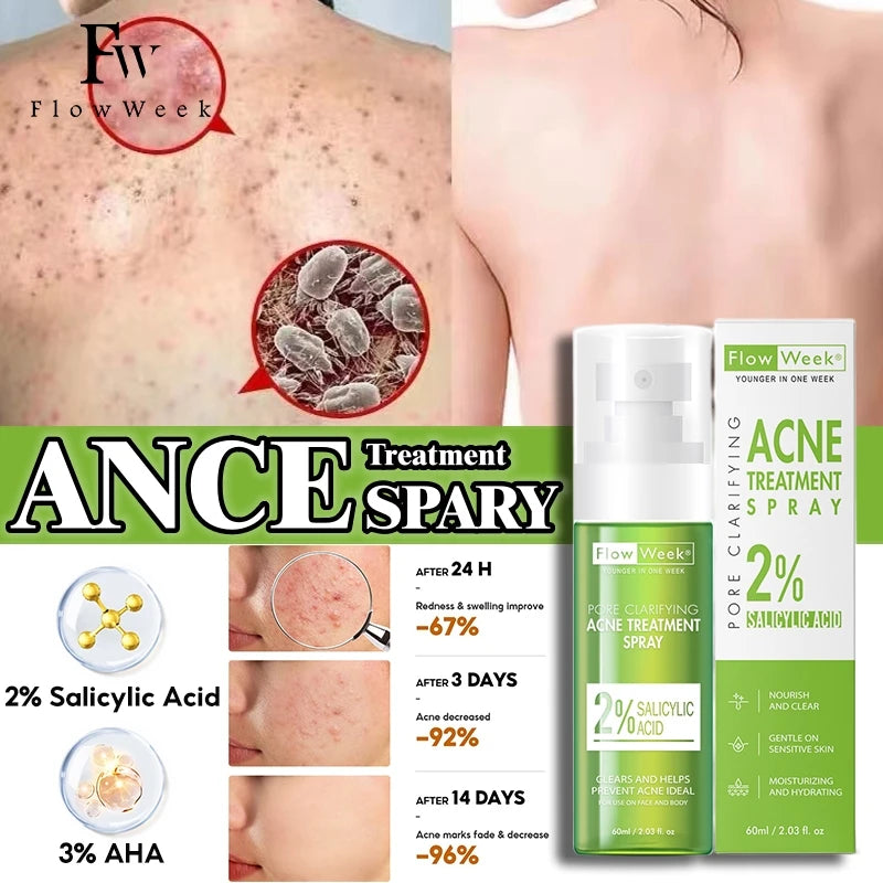 FlowWeek Salicylic Acid Acne Removal Spray,Remove Acne Cream, Back Spray, Face Body Acne Spray, Pimple Remover, Acne Treatment