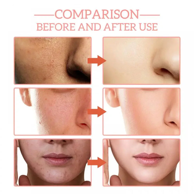 Hyaluronic Acid Wrinkle Remover Serum Niacinamide Fade Dark Spot Shrink Pores 5 In 1 Whitening For Moisturizing Face Skin Care