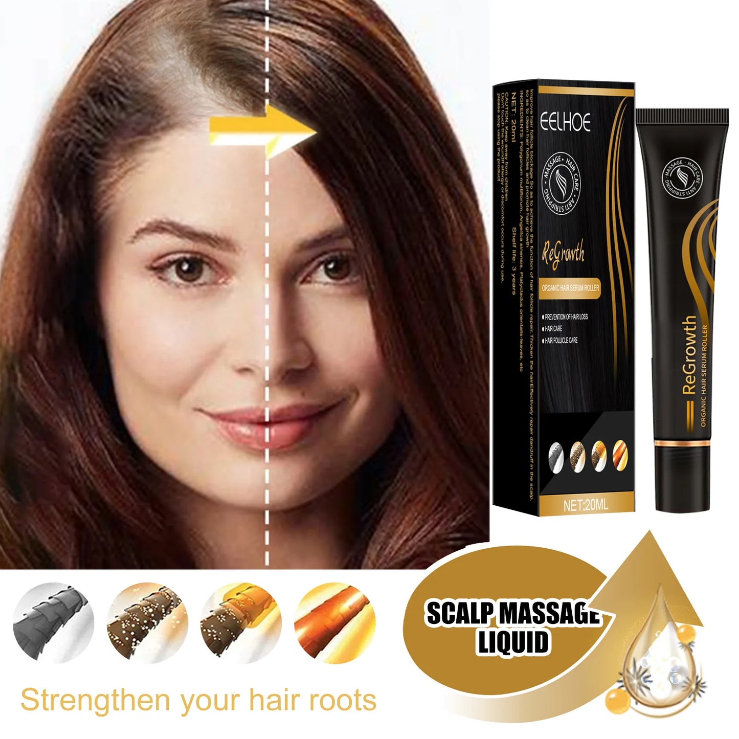 Hair Growth Essence Oil Roll-on Massage The Scalp To Accelerate Absorption Scalp Irritation Nourish Hair Roots Prevent Hair Loss