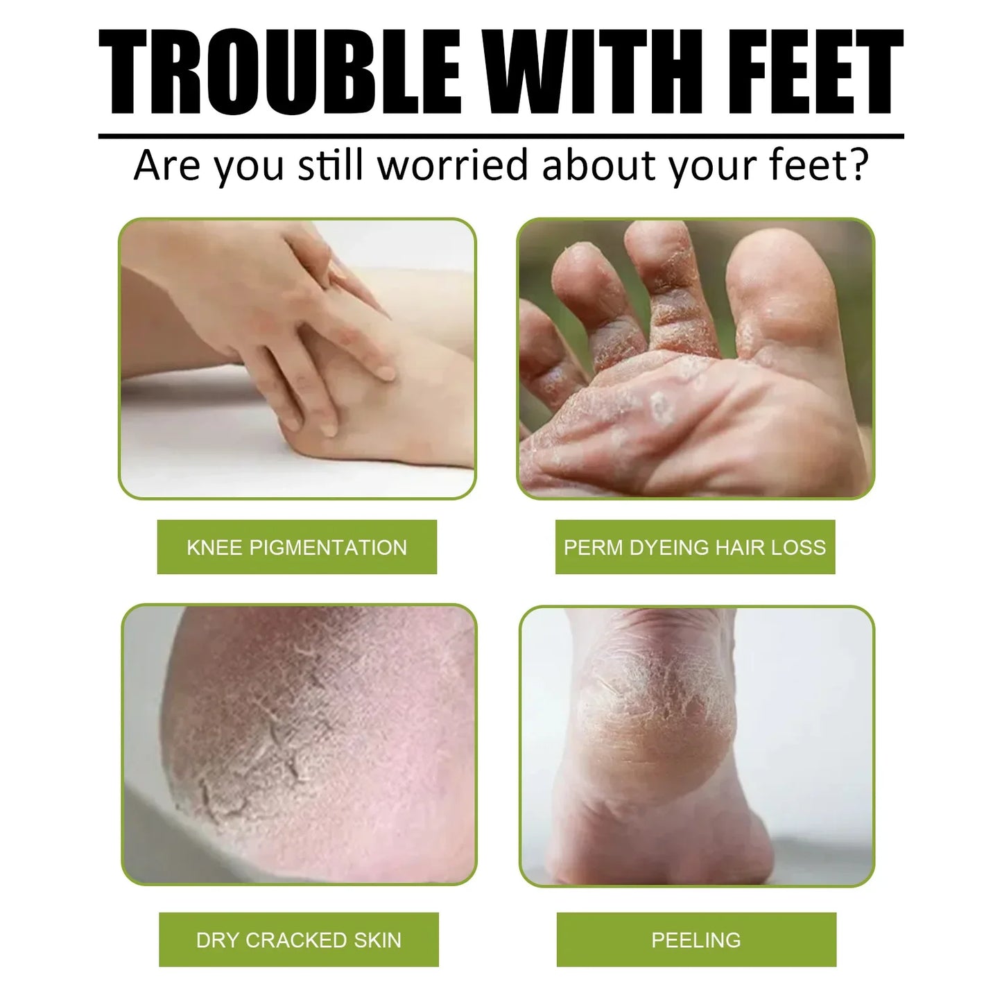 Foot Exfoliator Softener Remove Dead Skin Calluses Foot Mask Anti-Cracked Heel Enhancer Nail Pedicure Elbow Knee Exfoliation