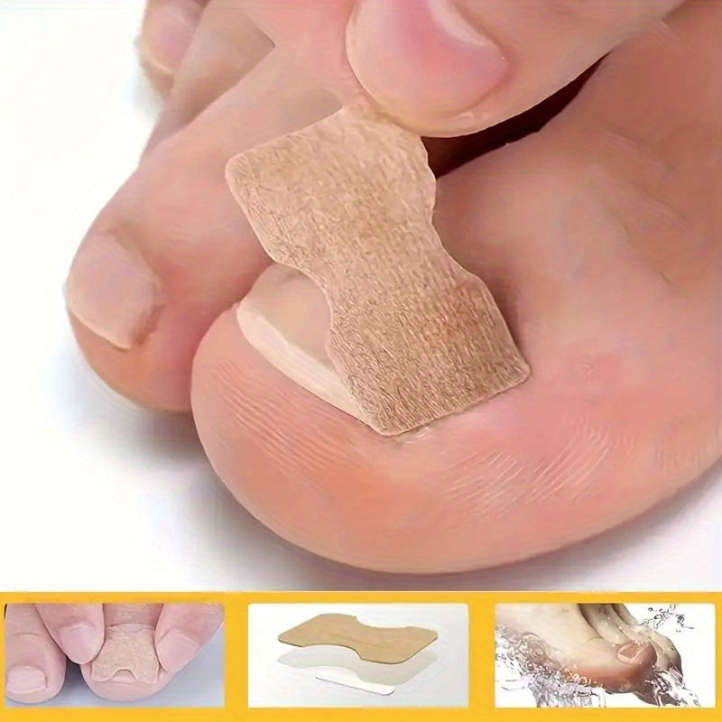 NEW Arrivals 160 PCS 16 Sheets Set Glue-On Toenail Correction Tapes - Instant Cover for Toenails, Hidden Holes & Bends, Nail Cover Strips, Easy Cut-to-Fit (No Sensitive Glue), for Sensitive Light Beige
