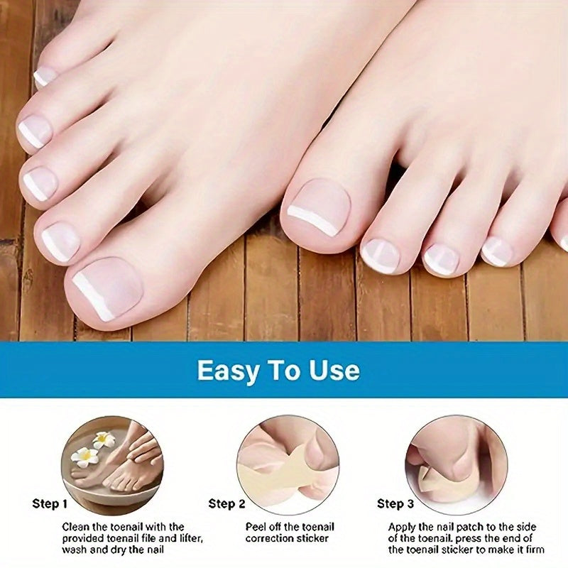 NEW Arrivals 160 PCS 16 Sheets Set Glue-On Toenail Correction Tapes - Instant Cover for Toenails, Hidden Holes & Bends, Nail Cover Strips, Easy Cut-to-Fit (No Sensitive Glue), for Sensitive Light Beige