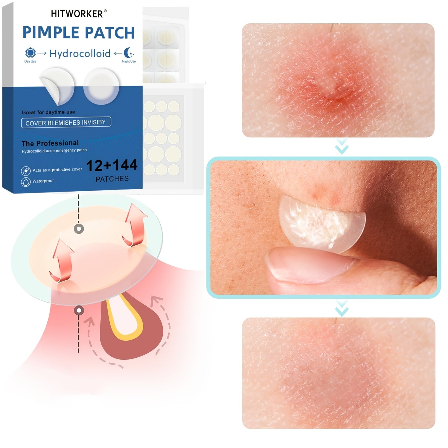 156 PCS Set of Day and Night Hydrocolloid Patches - Mild and Non-irritating, Cover and Blemishes - Essential for Facial Skin Care, Dust-free Paper Plastic Bag Sealed Packaging, Skin Care, Suitable for All Skin Types