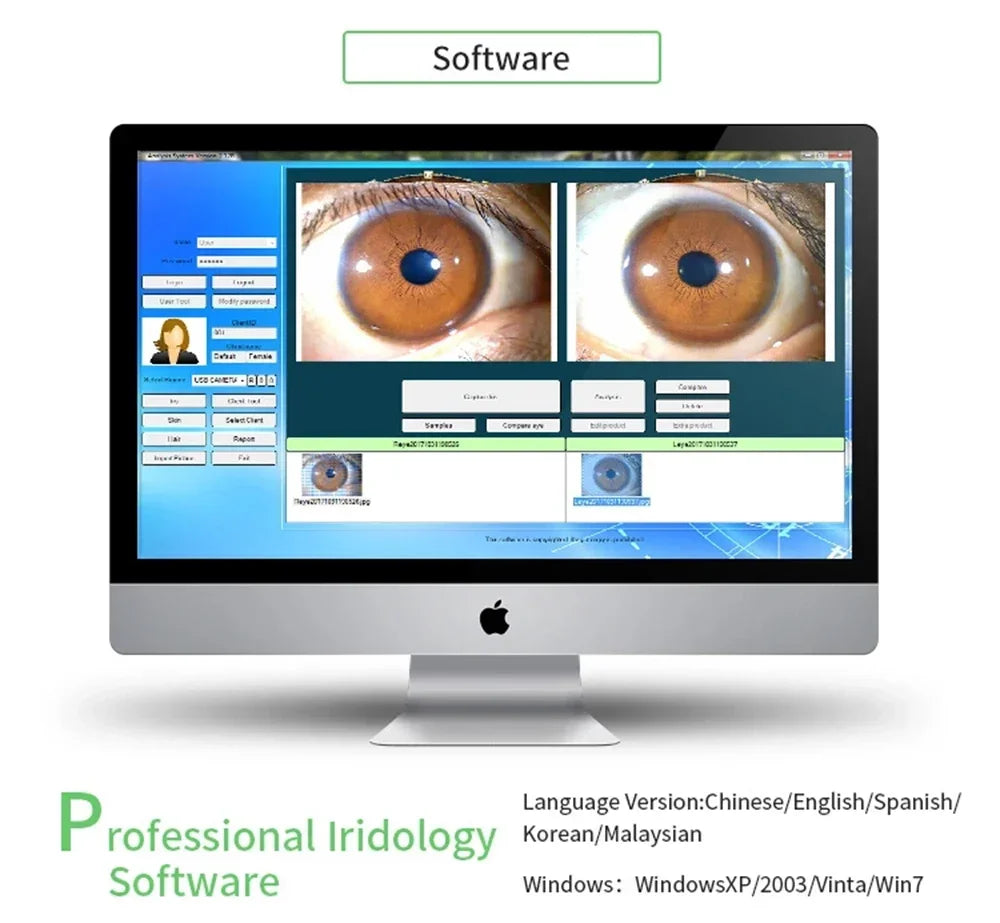 HOT SALE  Professional 3D Human Health Body Scanner Iris Camera Eye Iris Scope 12 Megapixel Iris Camera Analyzer Home Clinical Use