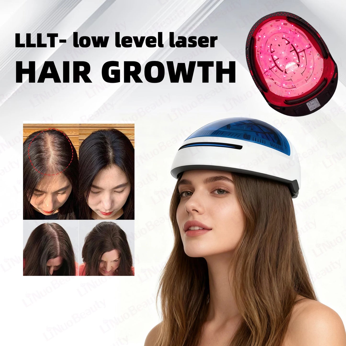 NEW 204 Diodes EMS Medical Laser Hair Growth Scalp Blood Circulation Helmet 650nm Red Light Therapy Cap Anti Hair Loss Baldness Treatment Hair Regrowth Device Women Men Hair Care Supplies.