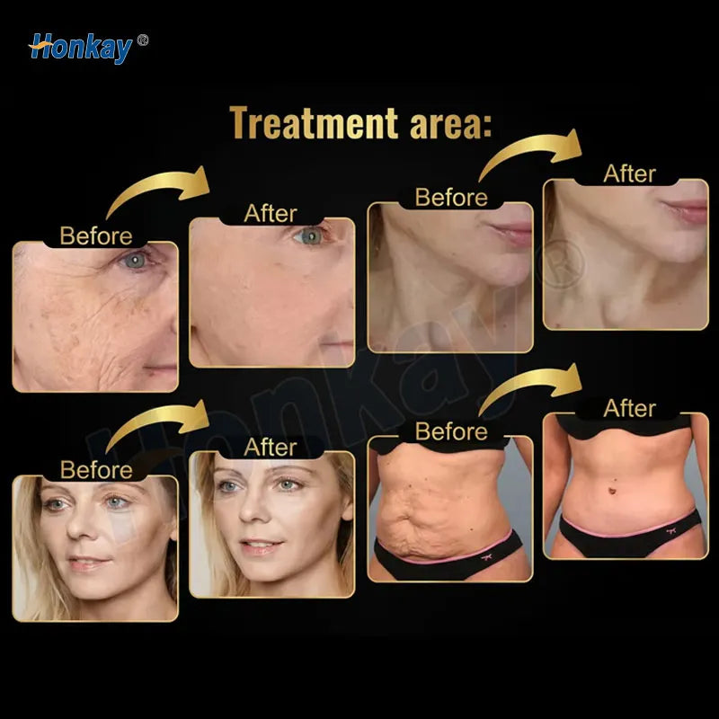 HOT SALE New Technology Professional Full Body 7D Machine Mask Face Body Legs Arms Lifting High Intensity Face Clean Brush Skin Firming Anti Aging Machine Women Skin Care Supplies