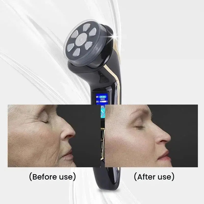 New Upgraded EMS Device Handheld Mini Machine Home Use 3 Cartridges Facial Lifting Anti-Wrinkle Anti-Aging Face Neck Eyes Dark Circles Remover Skin Tightening Women Skin Care Supplies