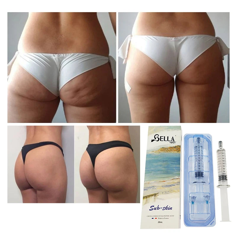 10ml NEW Bella HA Sub-Skin 10ml Injectable HA Gel Pure Hyaluronic Acid Anti-Wrinkle Whitening Dermal Filler Firming for Breast Buttock Penis Enhancement Gel Filler Injection for Women and Men