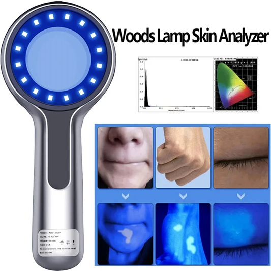 NEW AA20-Woods Lamp Skin Analyzer Skin UV Magnifying For Beauty Facial Full Body Testing Wood Lamp Light For Skin Care Analysis Testing