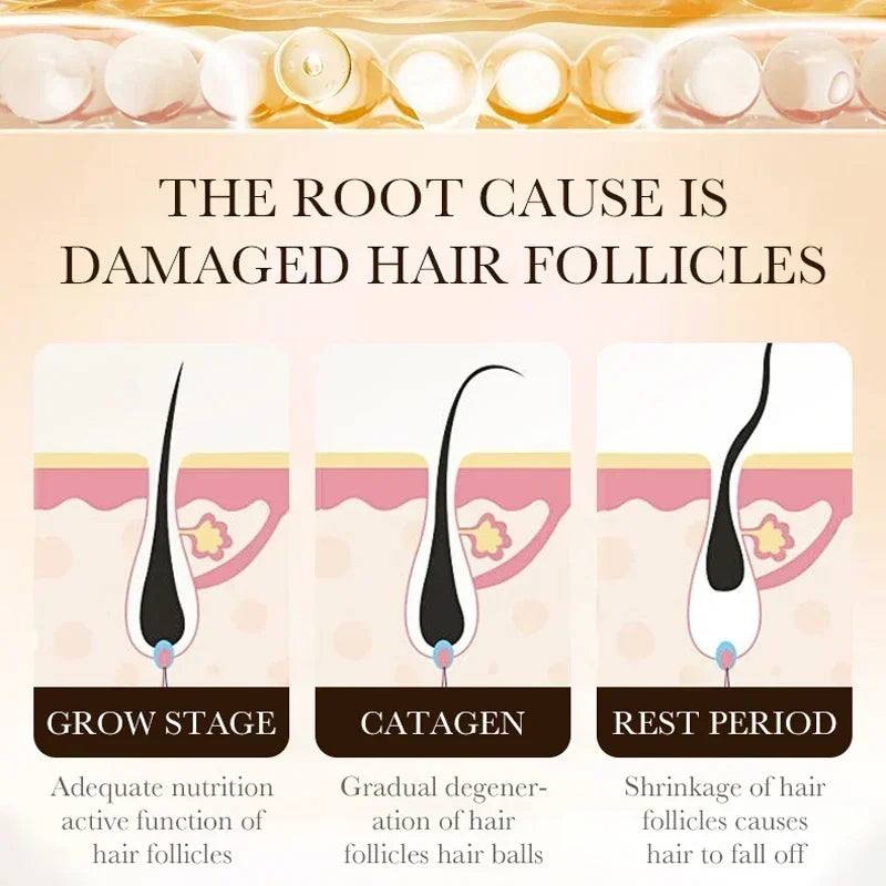 BIOTIN 1/3/5/10/22 PCS Set  fast Hair Growth Oil Products Care Scalp Massage Treatments Anti Hair Loss Effective Grow Thicker Hair Serum for Women Men Hair Care Accessories