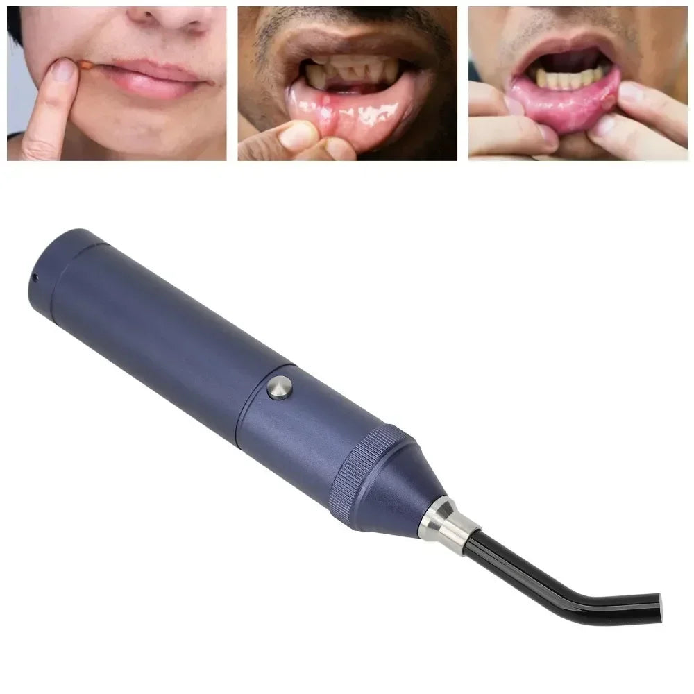 Professional  Red Blue Light LED Physiotherapy Flashlight Canker Sore Treat Devices Light Therapy Devices Lip Nose Ears Body Muscles