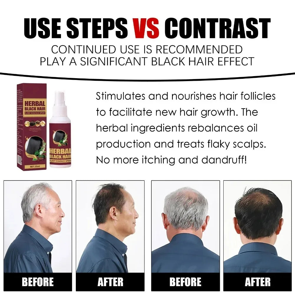 TikTok Hot-Selling Buy 10 Get 12 Free Herbal Black Hair Liquid for Frizz, Dryness, and Smoothness,  White Gray Hair Killer Remove  Restore Korean Hair Care Products