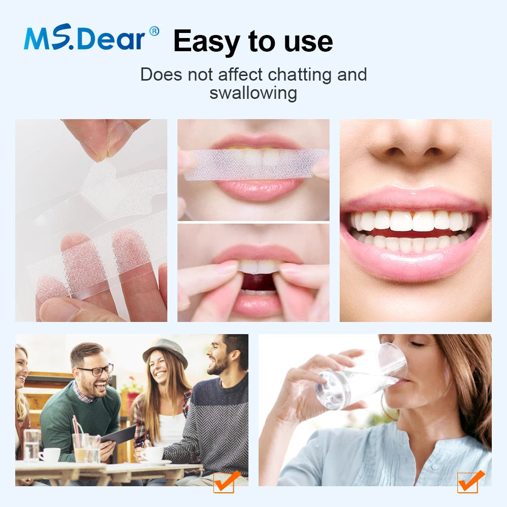 28-37-70 Pairs Set 9D Gel Teeth Whitening Strip White Tooth Dental Kit Oral Hygiene Care Strip False Teeth Veneers Whitening Gel Mint Scented Fresh Breath and Charming Smile