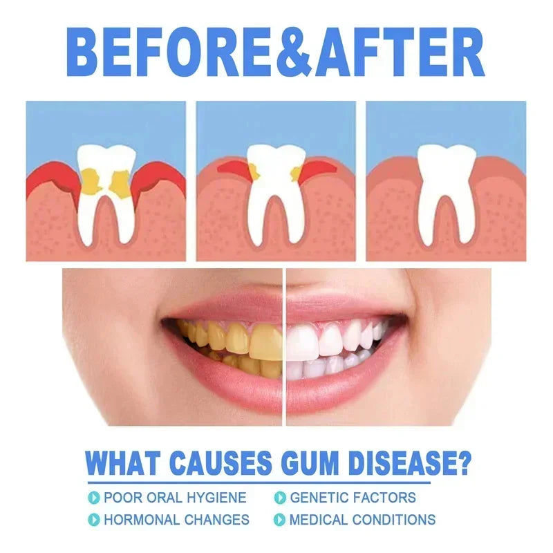 1/3/5/10 PCS Set Rapid Repair Gums Serum Effectively Relieve Tooth Allergy Dental Caries Tooth Cleaning Toothpaste Relieve Tooth Damage Drops Hygiene Accessories Health Care Supplies