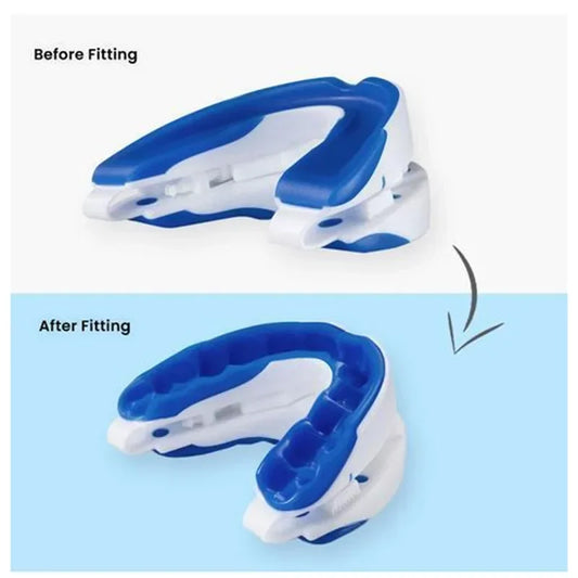 Transparent/White Color Anti-Snoring Mouthpiece Anti-Snoring Device Night Time Teeth Mouthguard Adjustable Sleeping Mouth Guard for Bruxism Stop Snoring