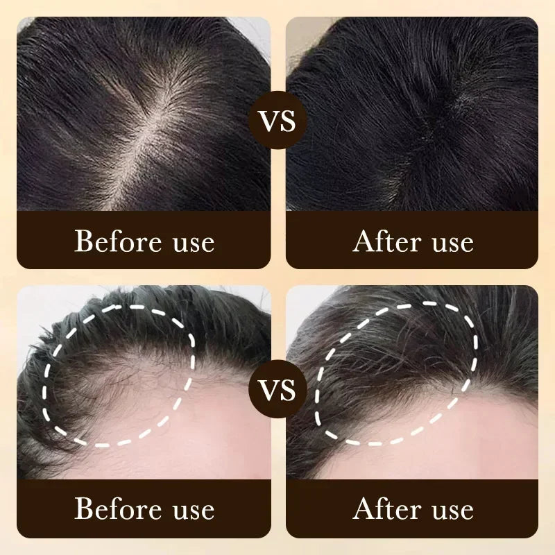1-22 PCS Set Biotin Fast Hair Growth Oil Products Care Scalp Repair Massage Treatments Anti Hair Loss Effective Grow Thicker Hair Serum for Women Men Hair Care Supplies
