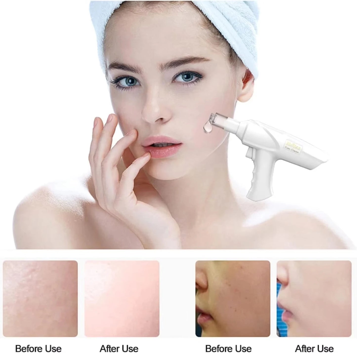 Customers Most Loved Skin Face Lifting Whitening Rejuvenation Firming Tightening Portable Mini Three-Color USB Digital Display Light Nano-Microcrystalline Non-Invasive Skin Care Beauty Salon Instrument Women Skin Care Supplie