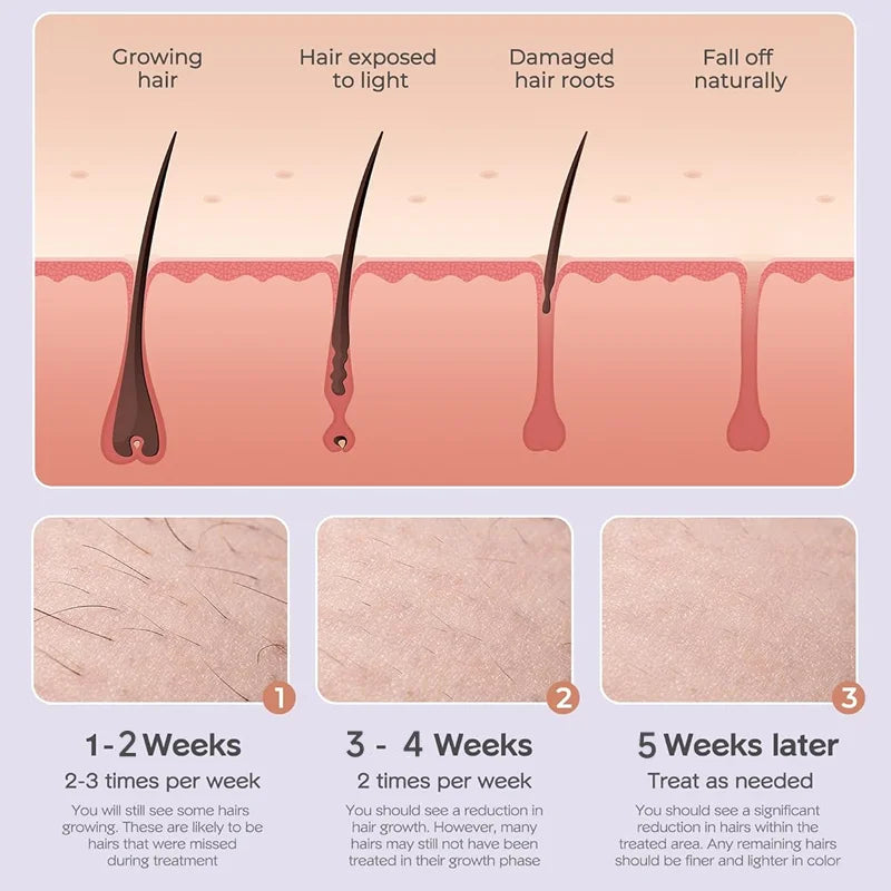 NEW IPL Touch Screen Hair Removal Epilator Laser Permanent Hair Removal Machine Face Body Electric Instrument  999999 Flashes Hair Care Supplies Skin Care Accessories