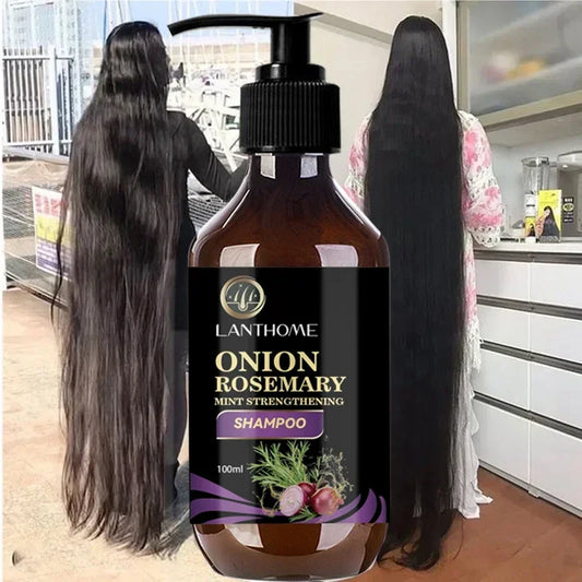 500ml Rosemary Hair Growth Thickening Shampoo Hair Growth Deep Cleansing Volumizing Shampoo Rosemary Onion Shampoo Hair Thickening Care Product