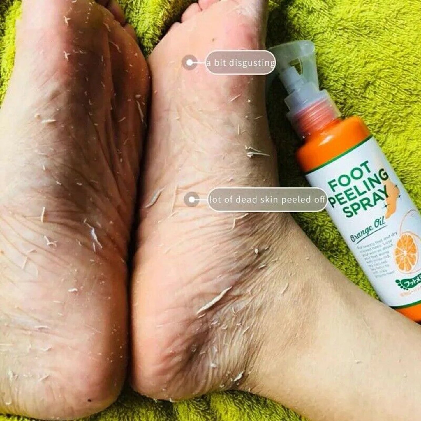 Buy 5 Get 5 Free 110ML Foot Cuticle Remove Dead Foot Exfoliator Softener Remove Dead Skin and Calluses Foot Mask Pedicure Nail Enhancer Women Men Skin Care Supplies