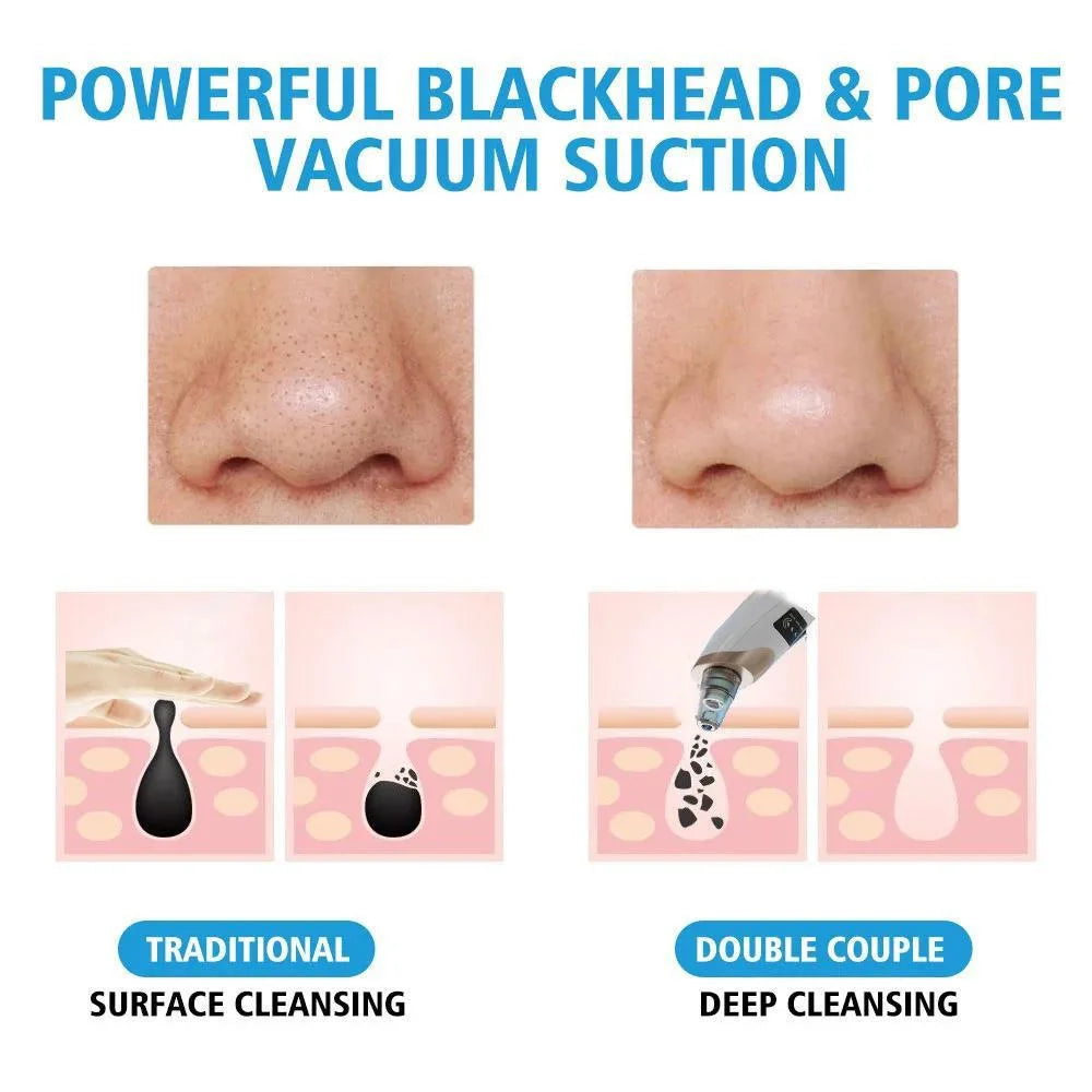 NEW Electric Pore Cleaner & Blackhead Remover, Vacuum Suction Device for Deep Cleansing, Home Facial Care Tool