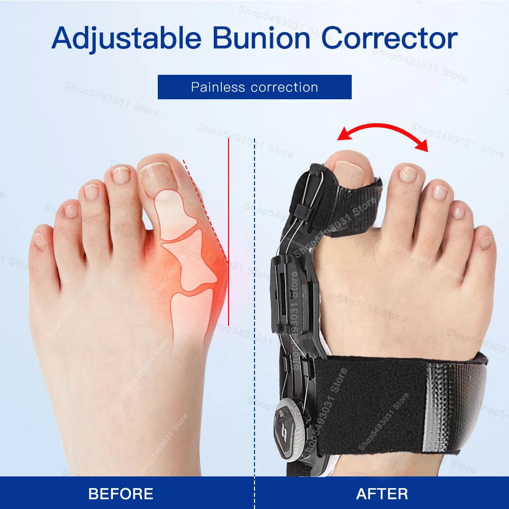 NEW Arrivals Bunion Corrector Unisex Foot Hallux Valgus Braces Rotatable Separator Straightener Adjustable Pedicure Finger Corrector Sports Medical Devices Set Supplies Health Care Products