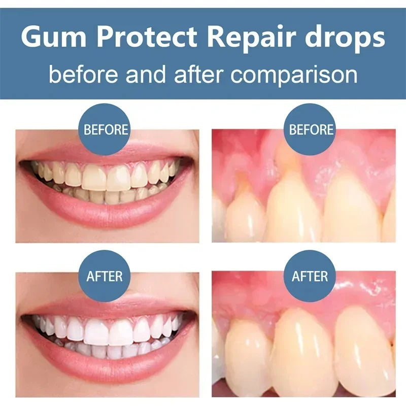 1/3/5/10 PCS Set Rapid Repair Gums Serum Effectively Relieve Tooth Allergy Dental Caries Tooth Cleaning Toothpaste Relieve Tooth Damage Drops Hygiene Accessories Health Care Supplies