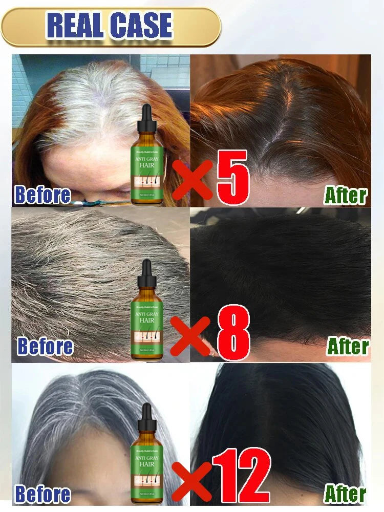 Natural Anti Gray Hair Serum - Repair White & Darkening Hair | Nourishing Hair Care Remedy