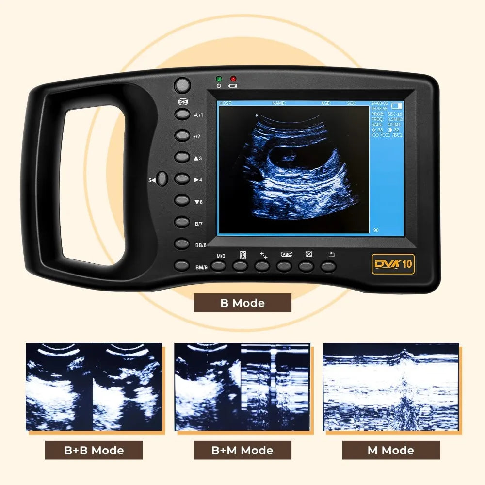 HOT SALE Portable Veterinary Ultrasound Scanner, Vet Pregnancy Ultra Machine with 3.5MHz Convex Probe for Horse Pig Sheep Goat Dogs Cow  Animals