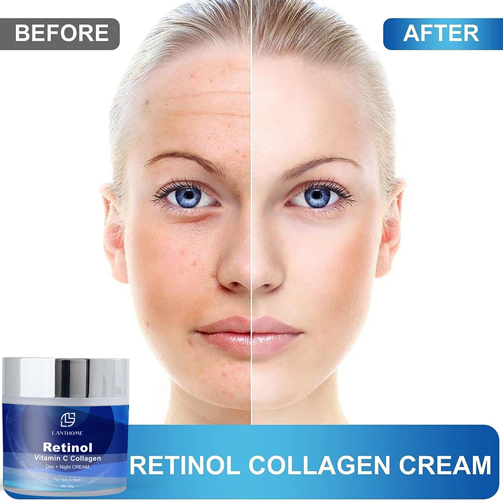 Retinol Professional Lanthome Whitening Collagen For Face Night and Day Reduces Wrinkles Lifting Brighten Moisturizing For Women