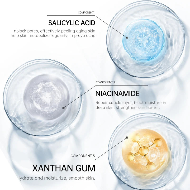 AUQUEST Acne Treatment Face Cream Salicylic Acid Acne Scar Pimple Remover Whitening Smoothing Facial Skin Care