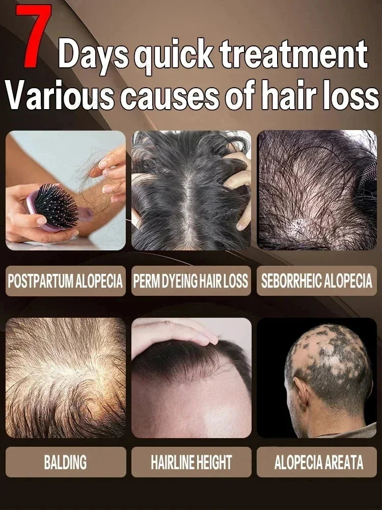 Buy 10 Get 12 Free Hair Growth Oil Products for Man Women Fast Regrowth Effective Baldness Repair Hereditary Anti Hair Loss Treatment Hair Care Sets
