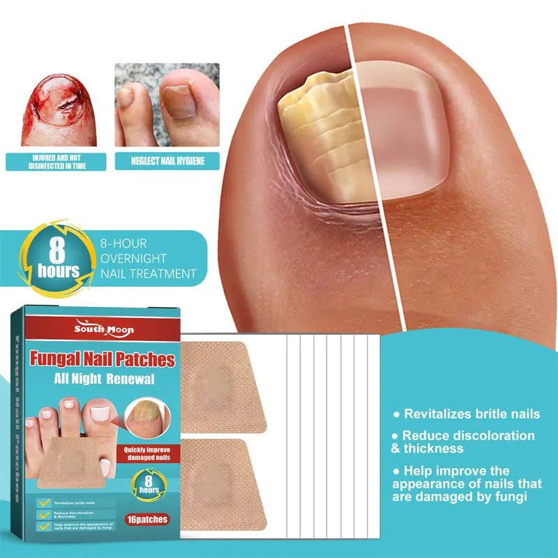 Nail Treatment Patch Anti Fungal Nail Correction Stickers Ingrown Toenail Care Paronychia Anti Infection Repair Patch