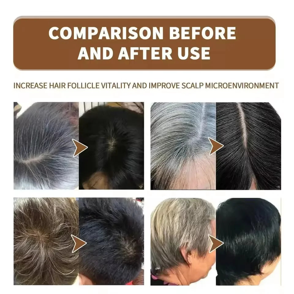 NEW Buy 3 Get 2 Free Korean Gray White Hair Treatment Serum Cover White Hair To Black Natural Color Repair Spray Anti Loss Hair Restore Healthy Hair Care Supplies