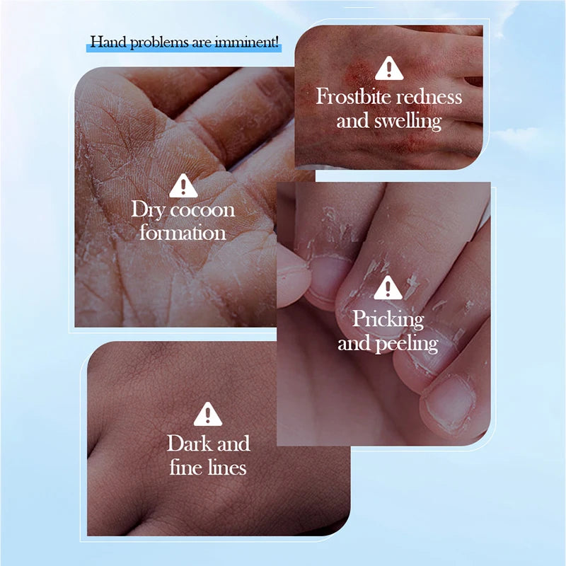 5 Pairs Set Coconut Moisturizing Hand Mask Whitening Nourishing Anti-Aging Hydrating Hand Gloves for Hands Korean Skin Care Products