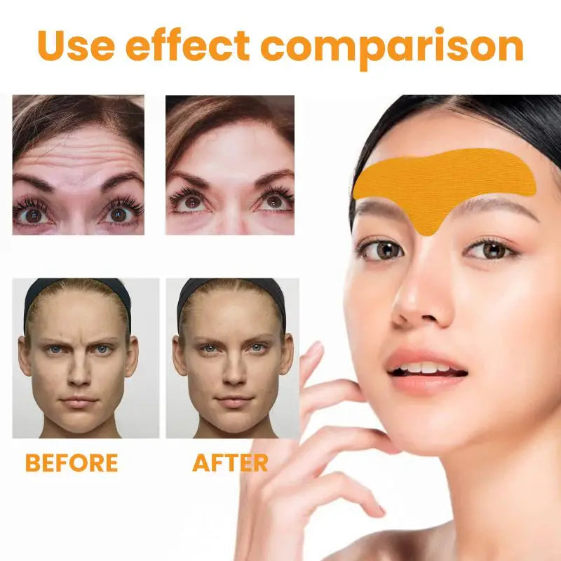 10pcs Anti-wrinkle Forehead Line Removal Gel Patch Firming Mask Frown Lines Face Skin Care Stickers Anti-aging Collagen Natural