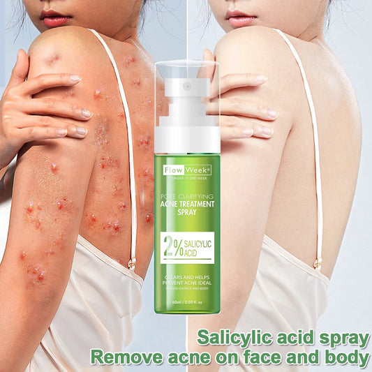 FlowWeek Salicylic Acid Acne Removal Spray，Remove Acne Cream, Back Spray, Face Body Acne Spray, Pimple Remover, Acne Treatment